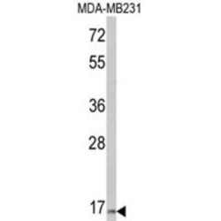 Thyrotropin Subunit Beta (TSHB) Antibody