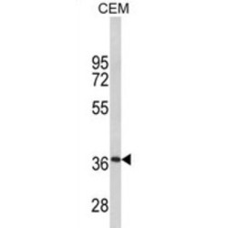 Protein Zero, Myelin (MPZ) Antibody