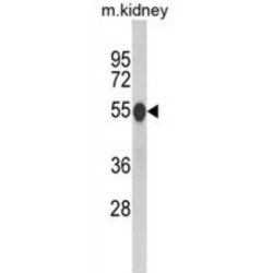 Catalase (CAT) Antibody