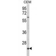 NKG2-C Type II Integral Membrane Protein (KLRC2) Antibody