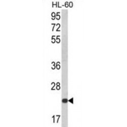 NKG2-C Type II Integral Membrane Protein (KLRC2) Antibody