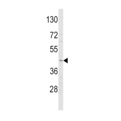 Adiponectin Receptor 1 (ADIPOR1) Antibody