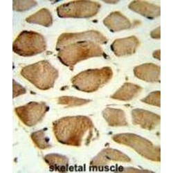 Caveolin 2 (CAV2) Antibody