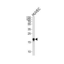 Caveolin 2 (CAV2) Antibody