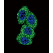 Cytochrome P450 4B1 (CYP4B1) Antibody