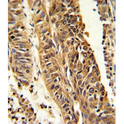 Cytochrome P450 4B1 (CYP4B1) Antibody