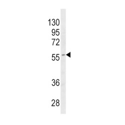 Cytochrome P450 4B1 (CYP4B1) Antibody