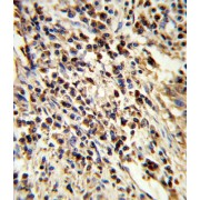 Proteasome Subunit Alpha Type 7 (PSMA7) Antibody