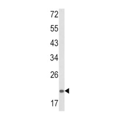 Proteasome Subunit Alpha Type 7 (PSMA7) Antibody