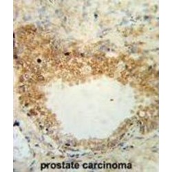 Desmocollin 1 (DSC1) Antibody