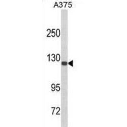 Desmocollin 1 (DSC1) Antibody