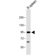 WB analysis of rat spleen whole tissue lysate (20 µg), using CBLB antibody (1/1000 dilution) and HRP-conjguated goat anti-rabbit IgG (H+L) (1/10000 dilution). Predicted band size: 109 kDa. Blocking/dilution buffer: 5% NFDM/TBST.