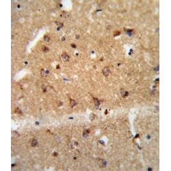 Glial Cell Line Derived Neurotrophic Factor (GDNF) Antibody