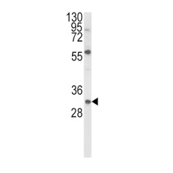 Glial Cell Line Derived Neurotrophic Factor (GDNF) Antibody