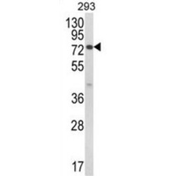 Janus Kinase And Microtubule Interacting Protein 1 (JAKMIP1) Antibody