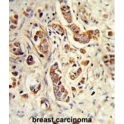 Putative Neutrophil Cytosol Factor 1C (NCF1C) Antibody