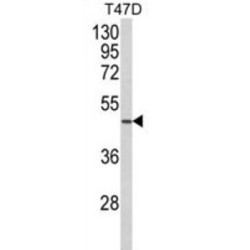 Putative Neutrophil Cytosol Factor 1C (NCF1C) Antibody