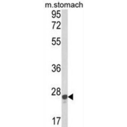 Glutathione S Transferase Alpha 1 (GSTA1) Antibody