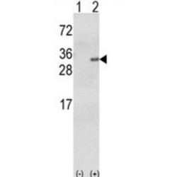 Glutathione S Transferase Alpha 1 (GSTA1) Antibody