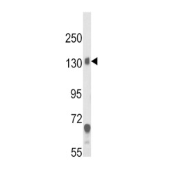 Calcium Voltage-Gated Channel Auxiliary Subunit Alpha2delta 1 (CACNA2D1) Antibody