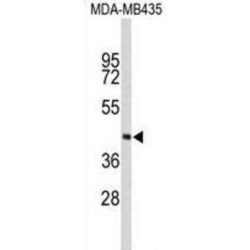 Phytanoyl-CoA 2-Hydroxylase (PHYH) Antibody