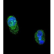 Hepatocyte Nuclear Factor 1 Alpha (HNF1A) Antibody