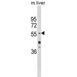 Hepatocyte Nuclear Factor 1 Alpha (HNF1A) Antibody