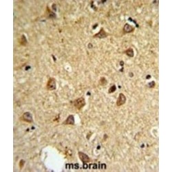 Type II Iodothyronine Deiodinase (DIO2) Antibody