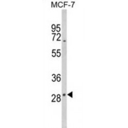 Type II Iodothyronine Deiodinase (DIO2) Antibody