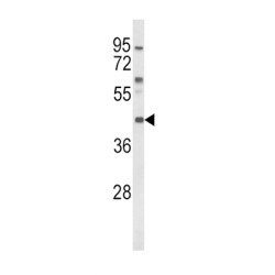 Melanocortin 3 Receptor (MC3R) Antibody