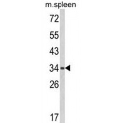G-patch Domain and Ankyrin Repeats 1 (GPANK1) Antibody
