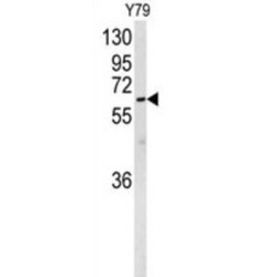 Neuralized E3 Ubiquitin Protein Ligase 1 (NEURL) Antibody