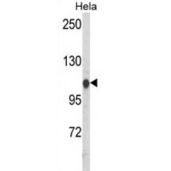 Heat Shock 70 kDa Protein 4L (HSPA4L) Antibody