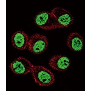 Polycomb Complex Protein BMI-1 (BMI1) Antibody