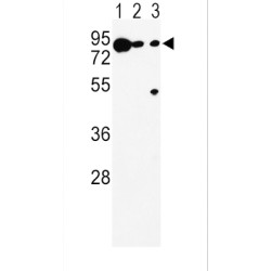 L-Dopachrome Tautomerase (DCT) Antibody