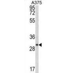 Collagen Triple Helix Repeat-Containing Protein 1 (CTHRC1) Antibody