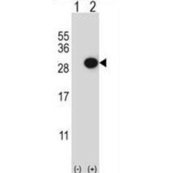 Collagen Triple Helix Repeat-Containing Protein 1 (CTHRC1) Antibody