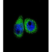 Cytochrome P450 7B1 (CYP7B1) Antibody