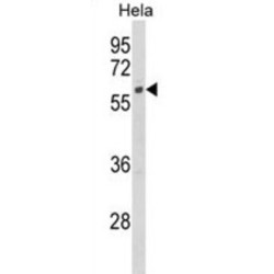 Cytochrome P450 7B1 (CYP7B1) Antibody