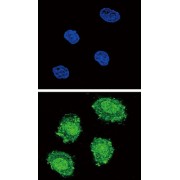 Suppressor of Cytokine Signaling 1 (SOCS1) Antibody