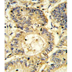 Suppressor of Cytokine Signaling 1 (SOCS1) Antibody