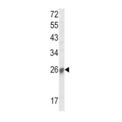 Suppressor of Cytokine Signaling 1 (SOCS1) Antibody