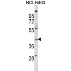 Formyl Peptide Receptor-Like 2 (FPRL2) Antibody