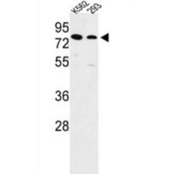 Neutral and Basic Amino Acid Transport Protein rBAT (SLC3A1) Antibody