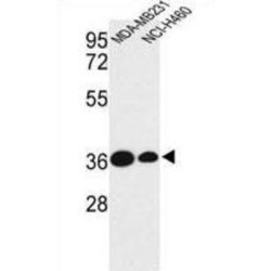 Tafazzin (TAZ) Antibody