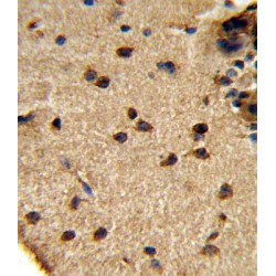 Glutaminase (GLS) Antibody