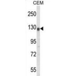 Potassium Voltage-Gated Channel Subfamily H Member 2 (KCNH2) Antibody