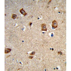 Integrin Alpha 1 (ITGA1) Antibody