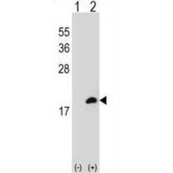 Coactosin-Like Protein (COTL1) Antibody