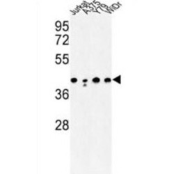 Soluble Calcium Activated Nucleotidase 1 (CANT1) Antibody